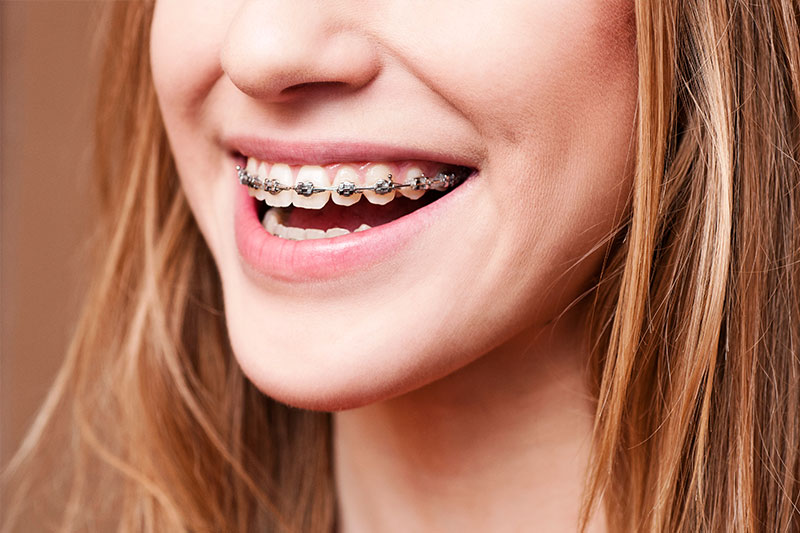 Orthodontics in Lake Forest